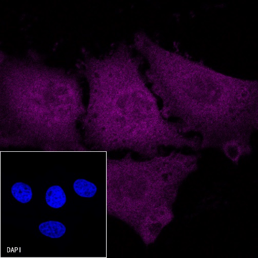 p16 Recombinant Rabbit mAb (Cy5 Conjugate) (S-303-1)