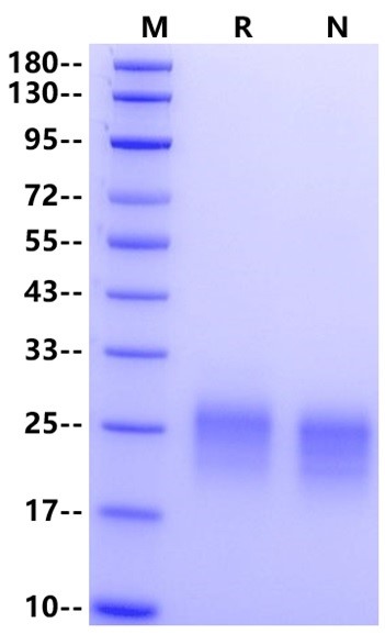 Frizzled-4/FZD4 His Tag Protein, Human
