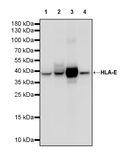 HLA-E Recombinant Rabbit mAb (S-1081-62)
