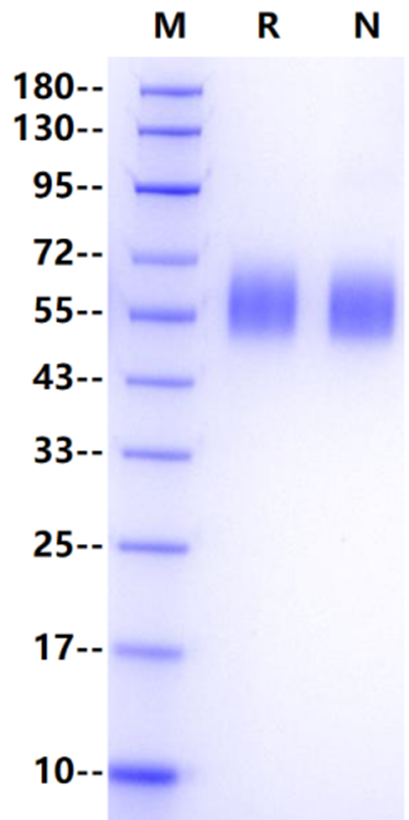 H1N1 HA1 (A/Brisbane/59/07) His Tag Protein