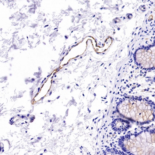 Von Willebrand Factor Recombinant Rabbit mAb (S-663-120)