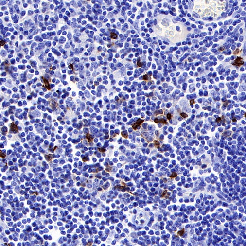 OX-40 Recombinant Rabbit mAb (S-R366)