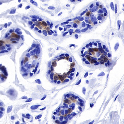 NY-BR-1 Recombinant Rabbit mAb (SDT-535-1)