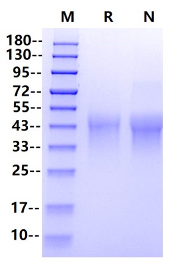 CD27/TNFRSF7 His Tag Protein, Human
