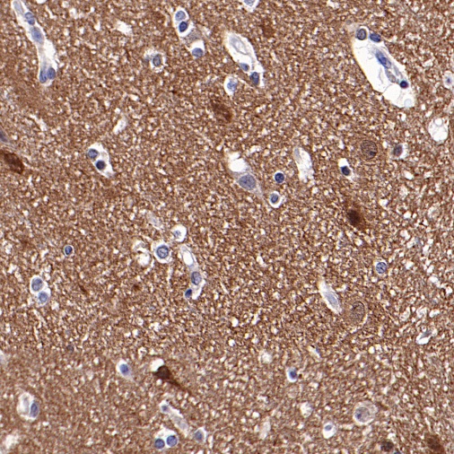 PAK1 Rabbit Polyclonal Antibody