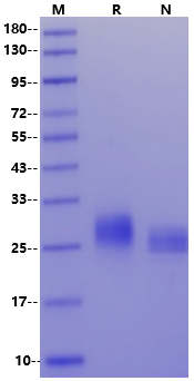 CLECSF6/DCIR/CLEC4A His Tag Protein, Mouse