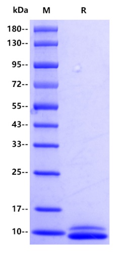 Mouse CXCL1 Protein, His tag