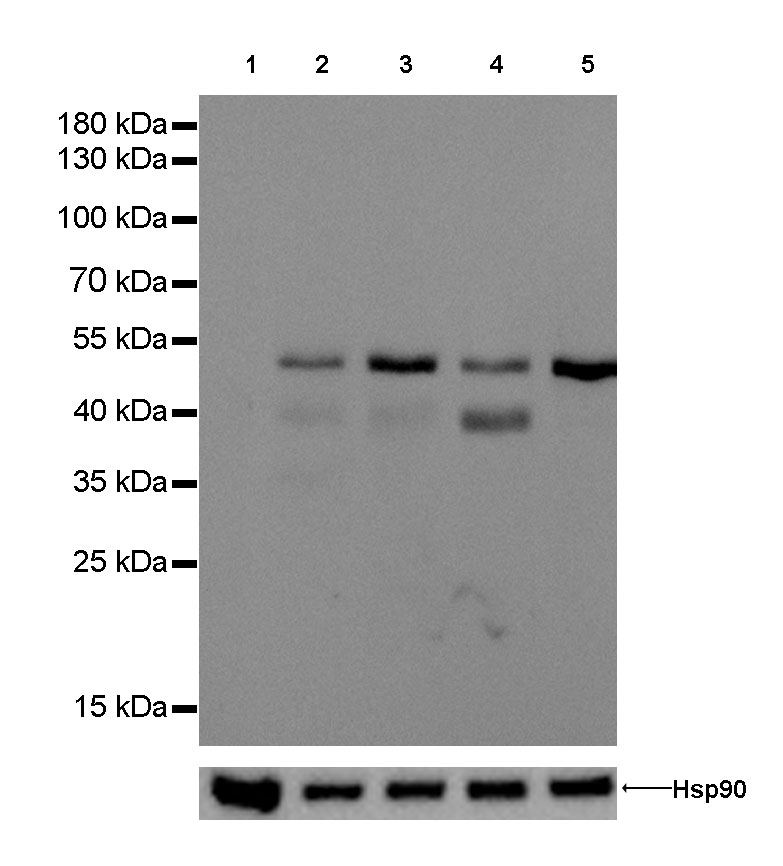 Keratin 8 Recombinant Rabbit mAb (SDT-016-46)
