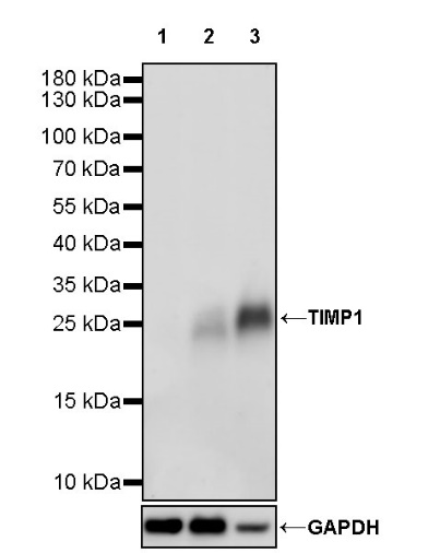 TIMP1 Recombinant Rabbit mAb (S-213-124)