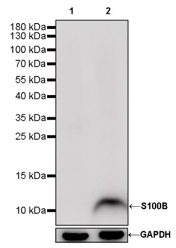 S-RMab® S100B Recombinant Rabbit mAb (SDT-518-45)
