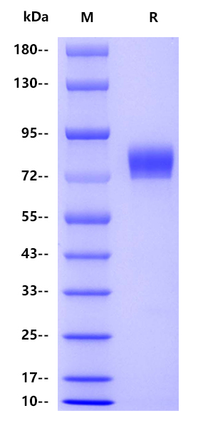Influenza A virus H1N1-HA（A/Nagasaki/HA-4/2009 H1N1）, His tag