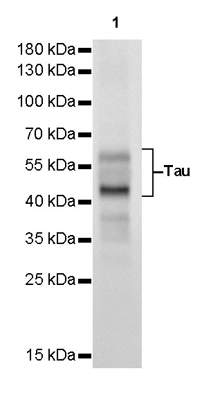 Tau Recombinant Rabbit mAb (SDT-171-67)