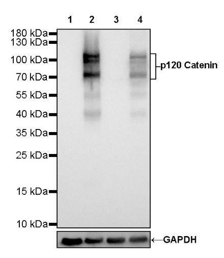 S-RMab® p120 Catenin Recombinant Rabbit mAb (SDT-350-75)