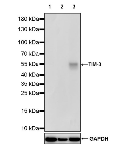 TIM-3 Recombinant Rabbit mAb (S-1450-21)