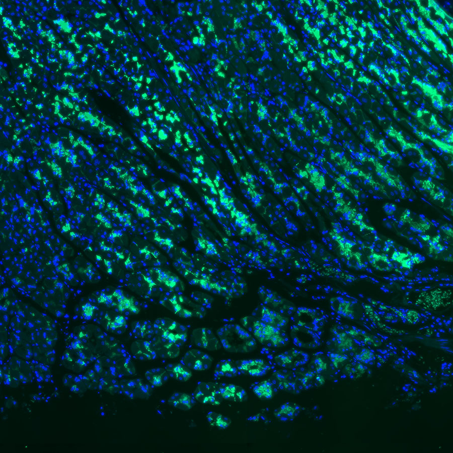 Claudin 18.2 Recombinant Rabbit mAb (FITC Conjugate) (SDT-102-24)