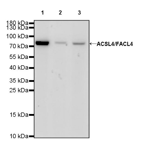 ACSL4/FACL4 Recombinant Rabbit mAb (S-461-6)