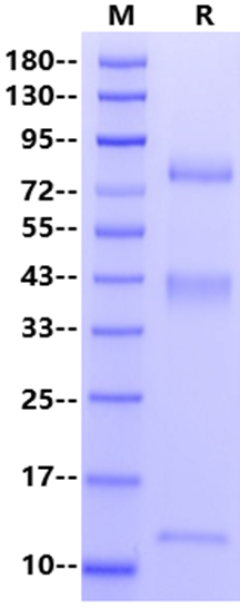 GARP&Latent TGF-β1 Heterotrimer His Tag Protein, Human