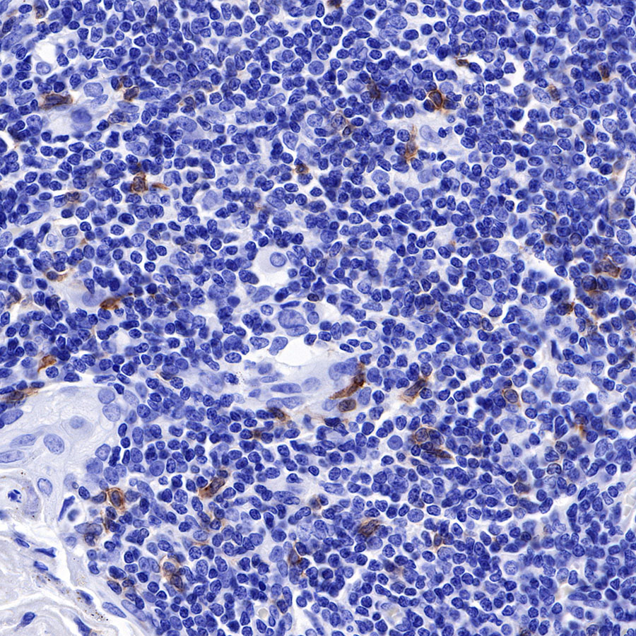 CD278/ICOS Recombinant Rabbit mAb (SDT-R104)