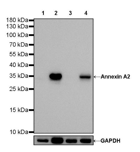 S-RMab®Annexin A2 Recombinant Rabbit mAb (SDT-444-67)