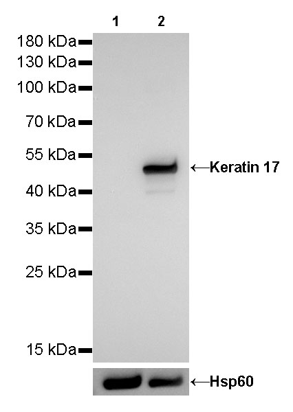 Keratin 17 Recombinant Rabbit mAb (SDT-011-43)