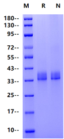 Prolactin R/PRLR His Tag Protein, Mouse