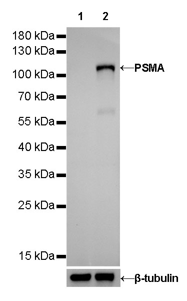 PSMA Recombinant Rabbit mAb (SDT-R075)