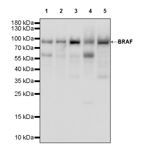 BRAF Recombinant Rabbit mAb (S-1328-60)