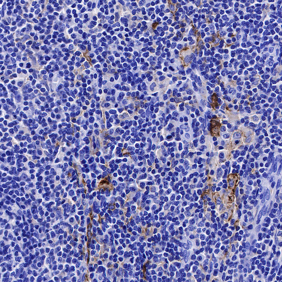 CD169 Recombinant Rabbit mAb (SDT-R153)