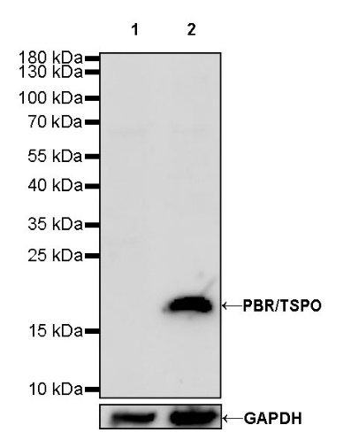 PBR/TSPO Recombinant Rabbit mAb (S-607-19)