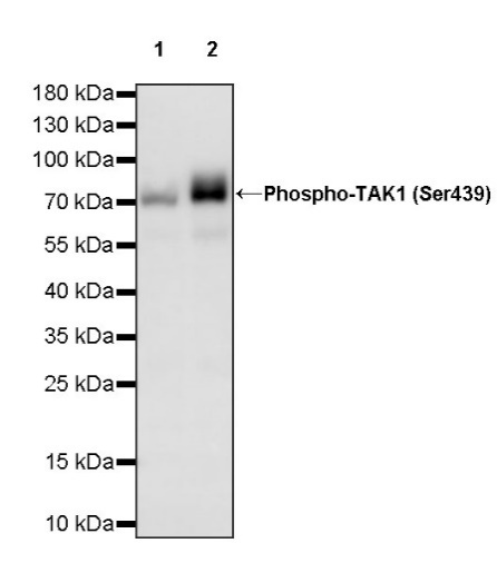 Phospho-TAK1 (Ser439) Recombinant Rabbit mAb (S-1136-46)