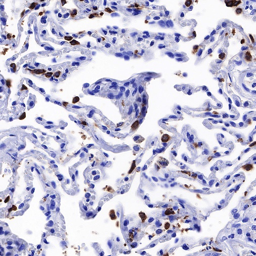 Surfactant Protein B Recombinant Rabbit mAb (SDT-435-18)