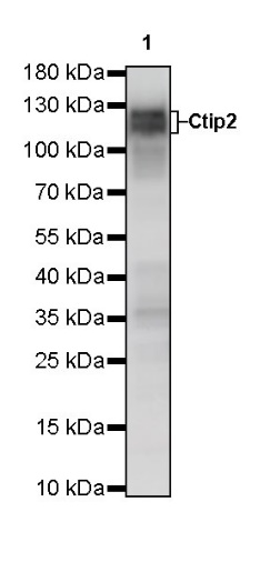 Ctip2 Recombinant Rabbit mAb (S-R314)