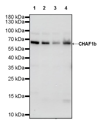 CHAF1b Recombinant Rabbit mAb (S-R316)
