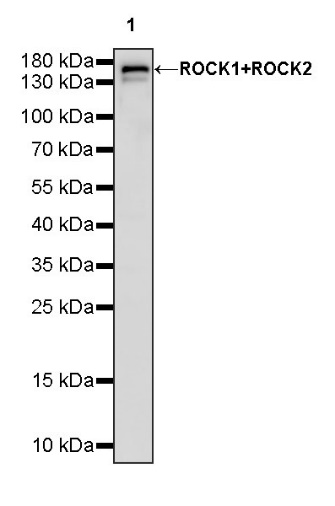 ROCK1+ROCK2 Recombinant Rabbit mAb (S-1305-26)