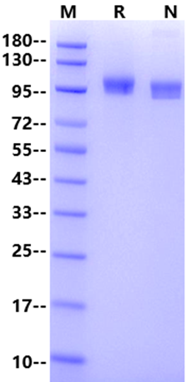 NCAM-1/CD56 His Tag Protein, Mouse