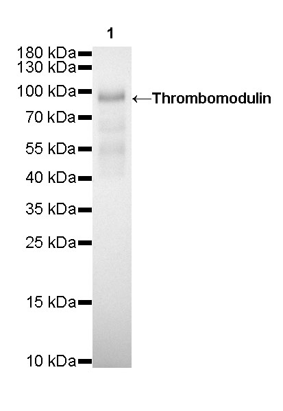 Thrombomodulin Recombinant Rabbit mAb (SDT-153-89)