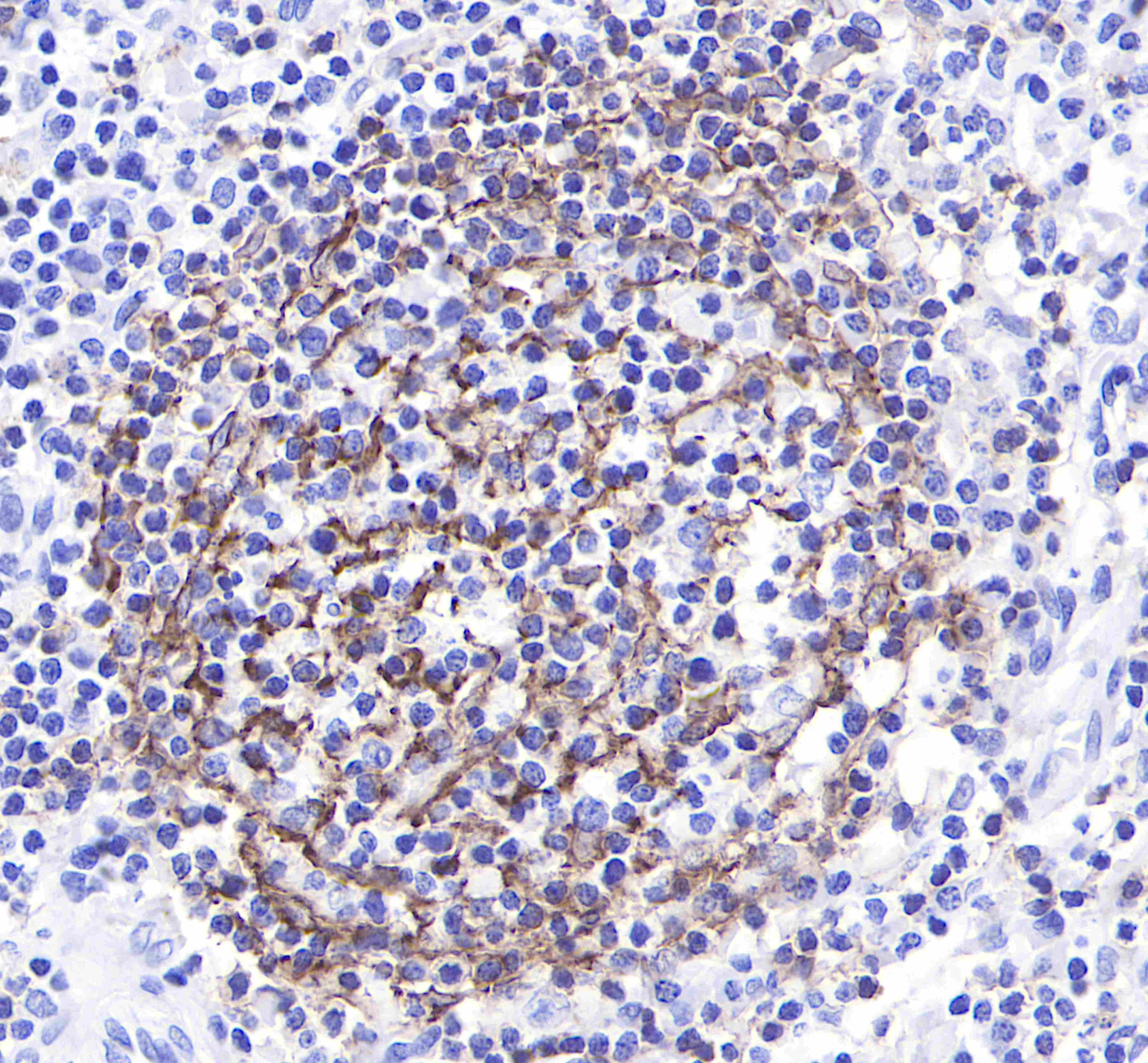 CD21 Recombinant Rabbit mAb (SDT-007-36)