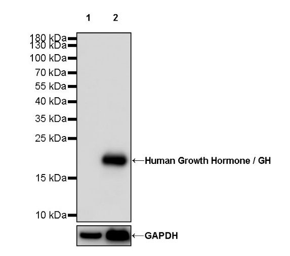 Human Growth Hormone / GH Recombinant Rabbit mAb (SDT-1160-40)