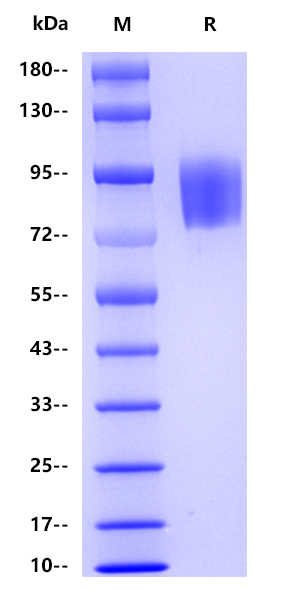 Human CD117 , His tag