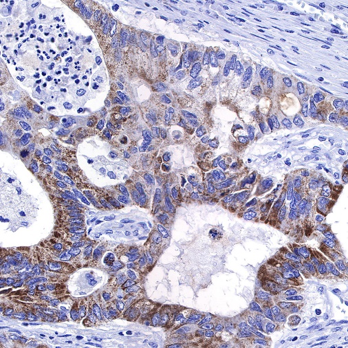 TMPRSS2 Recombinant Rabbit mAb (S-735-40)
