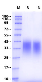 B7-H5/VISTA His Tag Protein, Human