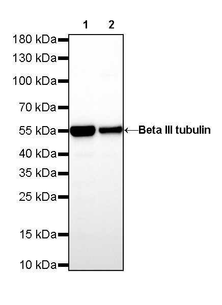 Beta III tubulin Recombinant Rabbit mAb (SDT-251-28)