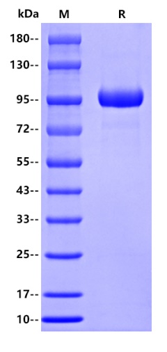 Human MMP-9 Protein, His tag