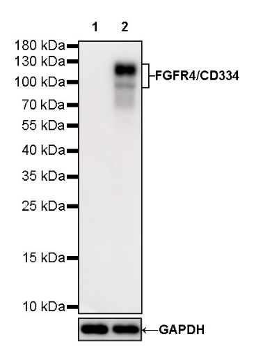 FGFR4/CD334 Recombinant Rabbit mAb (S-278-15)