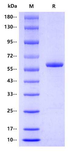 Human Catalase Protein, His tag
