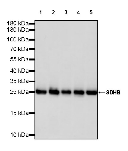 SDHB Recombinant Rabbit mAb (SDT-1162-2)