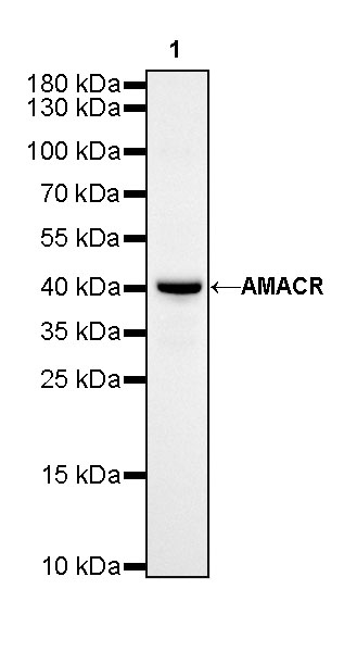 AMACR/p504s Recombinant Rabbit mAb (SDT-401-29)