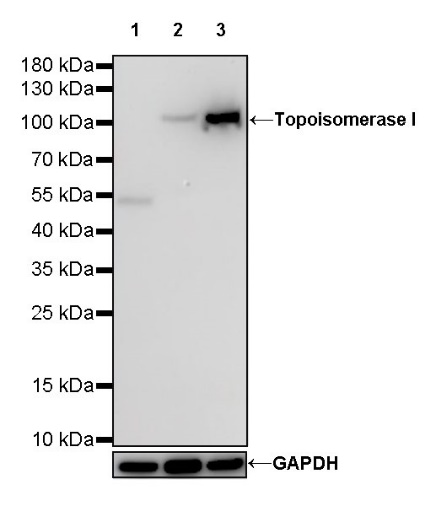 S-RMab®Topoisomerase I Recombinant Rabbit mAb (S-R209)