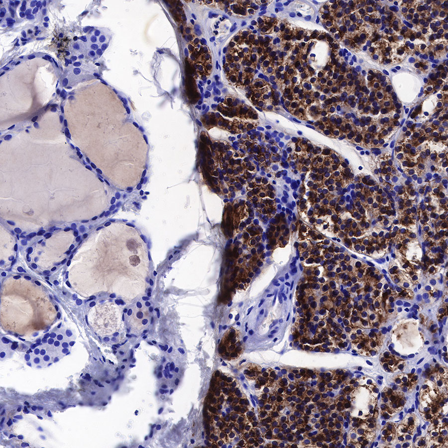 PTH Recombinant Rabbit mAb (SDT-407-4)
