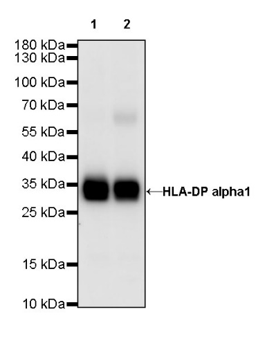 HLA-DP alpha1 Recombinant Rabbit mAb (S-R243)